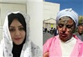 توضیح پزشکی قانونی درباره پرونده اسیدپاشی در تبریز 