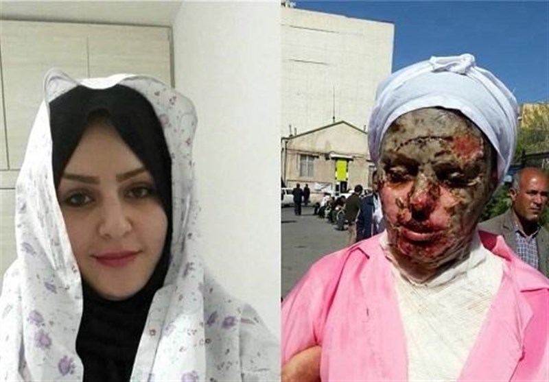 توضیح پزشکی قانونی درباره پرونده اسیدپاشی در تبریز 